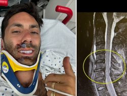 Nev Schulman Breaks Neck in Bike Accident