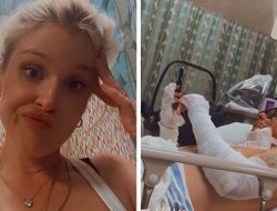 Kelly Osbourne Scolds Sid Wilson Over Severe Injuries From Burn Pile