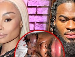 Blac Chyna Sued by Ex-Boyfriend Claiming She Beat Him Up In His Sleep