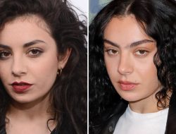 Charli XCX — Good Genes or Good Docs?!