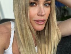 Teddi Mellencamp Details the Toughest Part of Her Melanoma Battle
